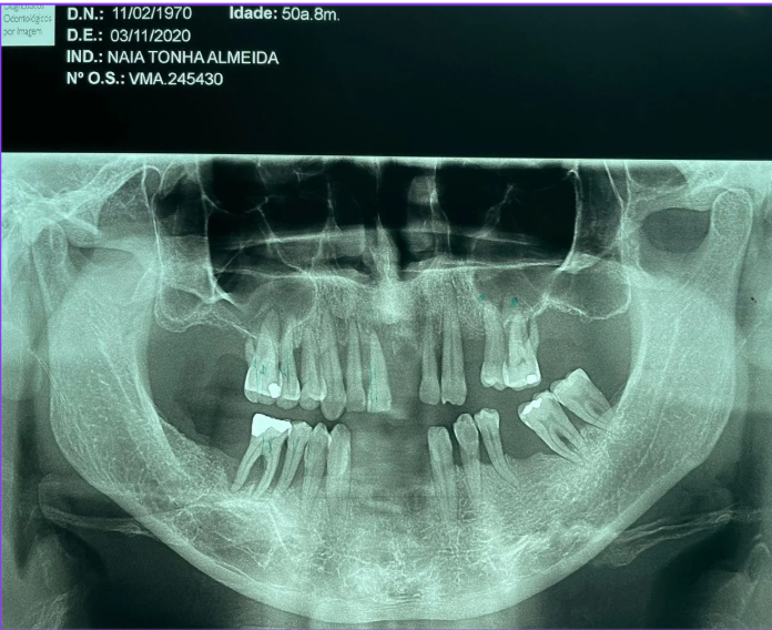 Quando a prevenção é ignorada, o dano é irreversivel! 5 zzz