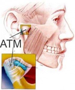 Articulação temporo-mandibular