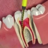 Endodontia