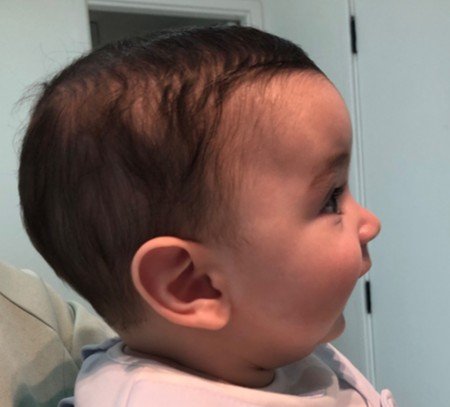 Por que avaliar o desenvolvimento facial do seu filho antes dos 6 anos faz toda a diferença